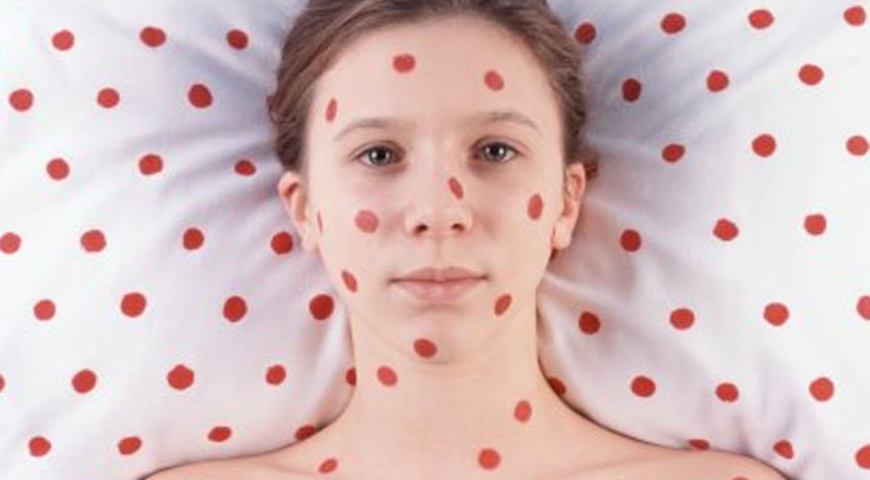 ЯК КІР ЗНИЩУЄ ІМУННУ СИСТЕМУ?