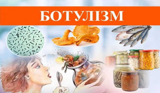 ЩО ВАЖЛИВО ЗНАТИ ПРО БОТУЛІЗМ