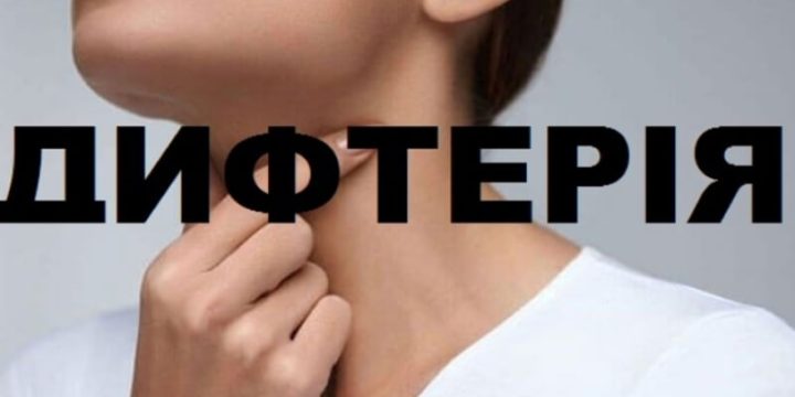 Дифтерія: як уберегтися від «смертельної ангіни»