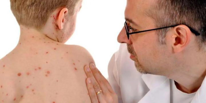 Кір під час подорожей: як убезпечити себе та близьких