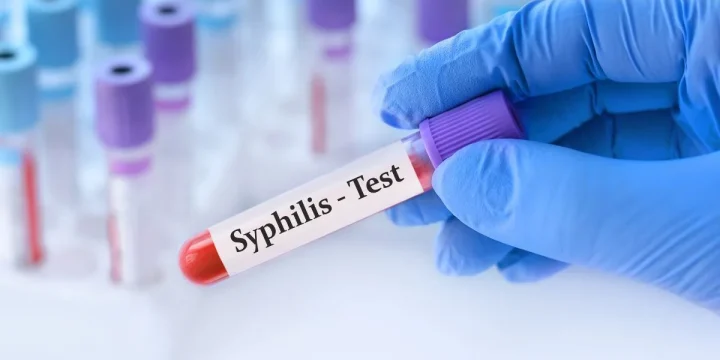 Сифіліс — хвороба, яку не можна ігнорувати
