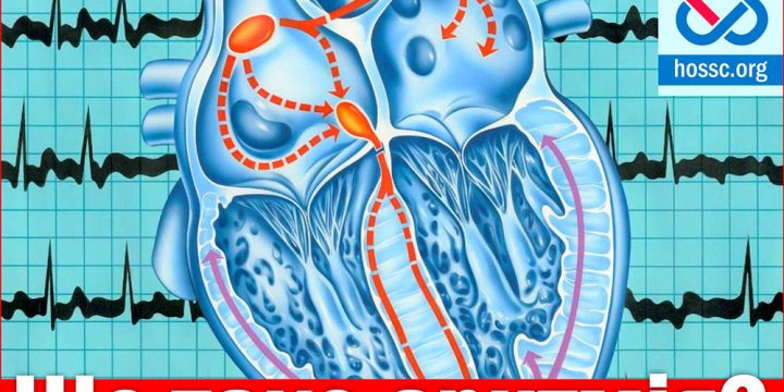 7–14 червня — Всесвітній тиждень серцевого ритму